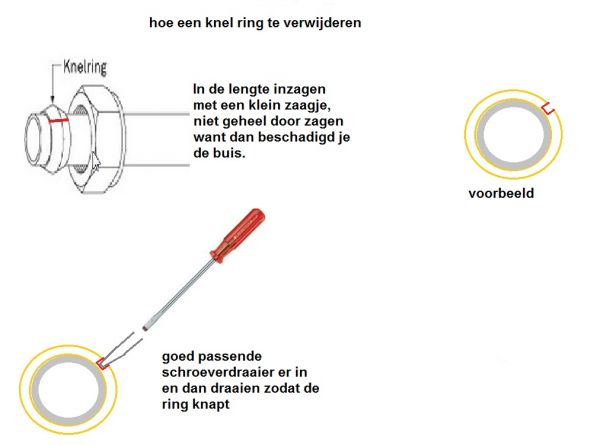 12496_hoe_een_knel_ring_te_verwijderen_3.jpg