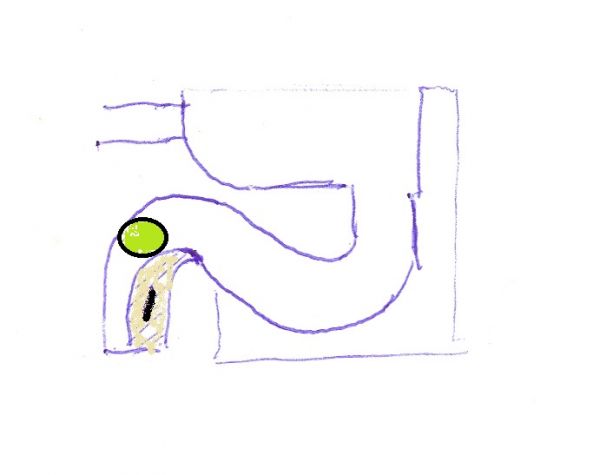 12496_verstopt_ook_door_urine_steen_1.jpg